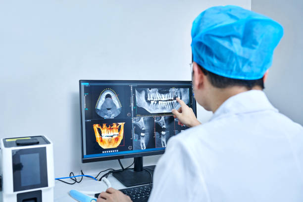 Best Emergency Dentist for Lost Fillings or Crowns in Hypoluxo, FL